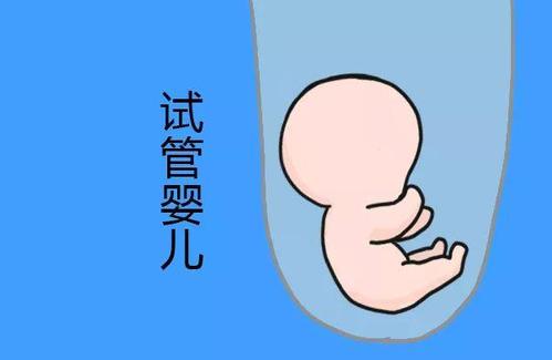 第三代试管婴儿 PGT